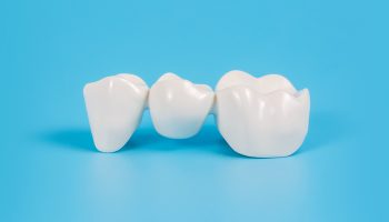The Time Frame for Getting a Dental Bridge After a Tooth Extraction
